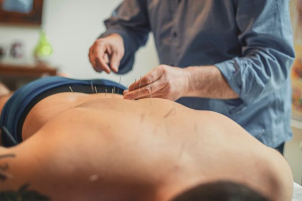 tratamiento en acupuntura